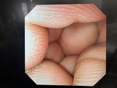 Video Gastroscope&nbsp;|&nbsp;OLYMPUS&nbsp;|&nbsp;GIF-XP290N