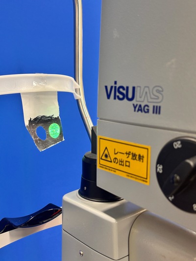 YAG Laser + 532 Green Laser Combination&nbsp;|&nbsp;Carl Zeiss&nbsp;|&nbsp;Visulas Combi YAG III 532s