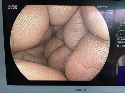 Video Gastroscope&nbsp;|&nbsp;FUJIFILM&nbsp;|&nbsp;EG-L600ZW7