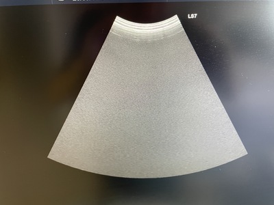 Color Doppler&nbsp;|&nbsp;GE&nbsp;|&nbsp;Logiq S7 Expert