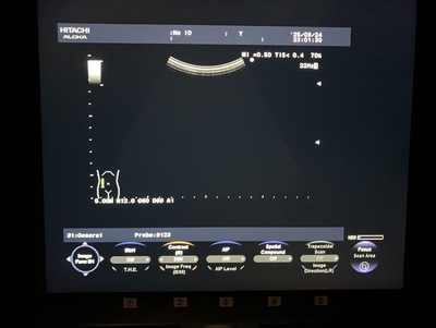 Color Doppler&nbsp;|&nbsp;HITACHI&nbsp;|&nbsp;F37