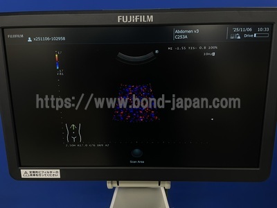 超音波診断装置&nbsp;|&nbsp;富士フィルムヘルスケア株式会社&nbsp;|&nbsp;ARIETTA 50の写真