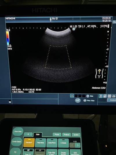 Ultrasound System&nbsp;|&nbsp;FUJIFILM&nbsp;|&nbsp;ARIETTA 850