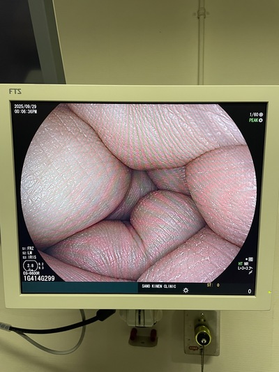 Endoscope System&nbsp;|&nbsp;FUJIFILM&nbsp;|&nbsp;EP-6000