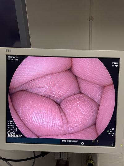 Video Gastroscope&nbsp;|&nbsp;FUJIFILM&nbsp;|&nbsp;EG-530NW