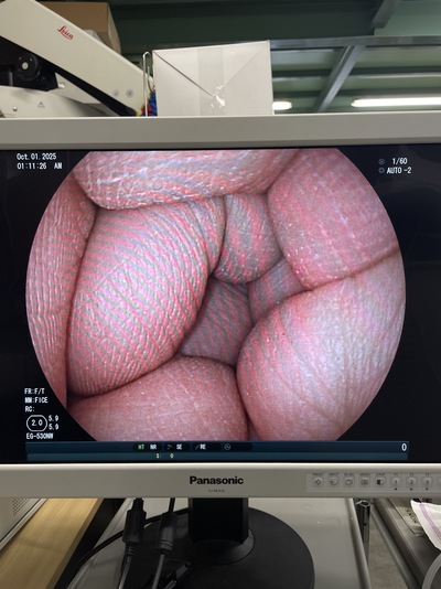 Video Gastroscope&nbsp;|&nbsp;FUJIFILM&nbsp;|&nbsp;EG-530NW