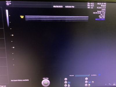 4D Ultrasound&nbsp;|&nbsp;GE&nbsp;|&nbsp;Voluson S10 BT16