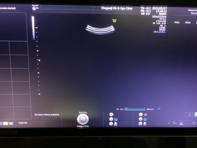 4D Ultrasound&nbsp;|&nbsp;GE&nbsp;|&nbsp;Voluson E10 BT17