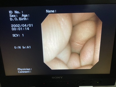 Video Gastroscope&nbsp;|&nbsp;OLYMPUS&nbsp;|&nbsp;GIF-XP260