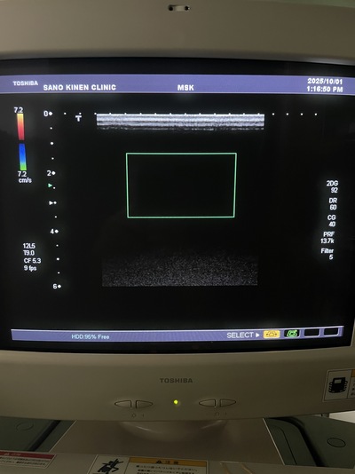 Ultrasound Color Doppler&nbsp;|&nbsp;CANON&nbsp;|&nbsp;SSA-700A Aplio50