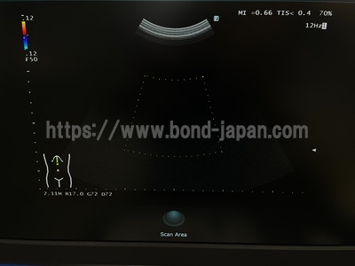 超音波診断装置&nbsp;|&nbsp;富士フィルムヘルスケア株式会社&nbsp;|&nbsp;ARIETTA 50の写真