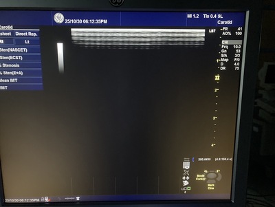 Color Doppler&nbsp;|&nbsp;GE&nbsp;|&nbsp;Logiq S7 Expert