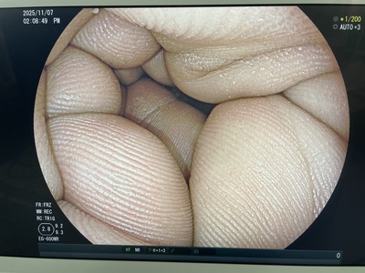 Video Gastroscope&nbsp;|&nbsp;FUJIFILM&nbsp;|&nbsp;EG-600WR