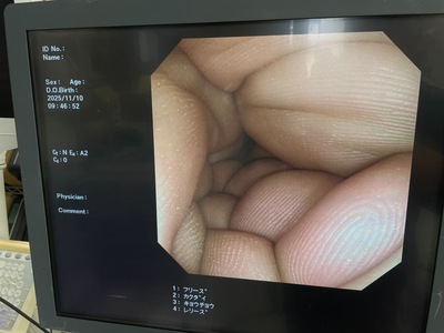 Endoscopy System&nbsp;|&nbsp;OLYMPUS&nbsp;|&nbsp;CV-170 Optera