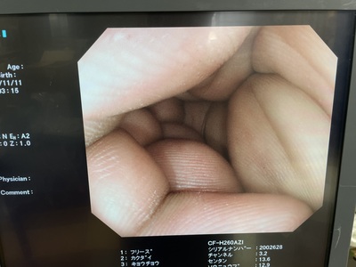 Video Colonoscope&nbsp;|&nbsp;OLYMPUS&nbsp;|&nbsp;CF-H260AZI