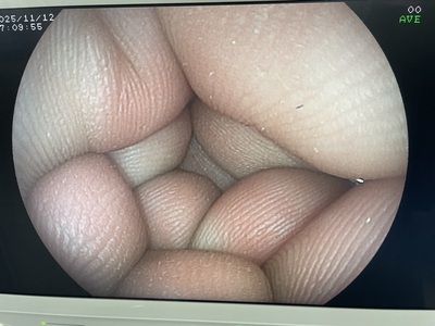 Video Gastroscope&nbsp;|&nbsp;FUJIFILM&nbsp;|&nbsp;EG-3000FP