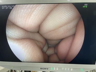 Video Gastroscope&nbsp;|&nbsp;FUJIFILM&nbsp;|&nbsp;EG-3000FP