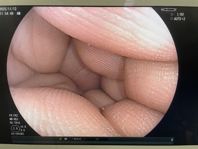 Gastroscope&nbsp;|&nbsp;FUJIFILM&nbsp;|&nbsp;EG-590ZW2