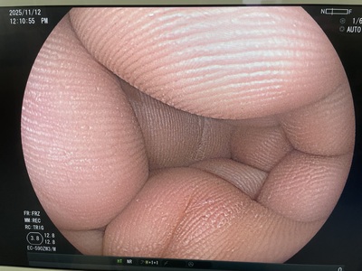 Video Colonoscope&nbsp;|&nbsp;FUJIFILM&nbsp;|&nbsp;EC-590ZW3/M