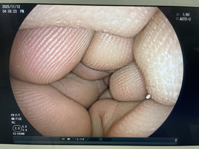 &nbsp;|&nbsp;FUJIFILM&nbsp;|&nbsp;EG-580NW