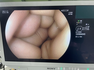 Video Gastroscope&nbsp;|&nbsp;FUJIFILM&nbsp;|&nbsp;EG-L590ZW