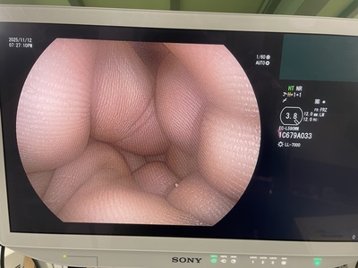 Colonoscope&nbsp;|&nbsp;FUJIFILM&nbsp;|&nbsp;EC-L590WM