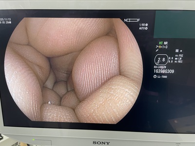 Video Gastroscope&nbsp;|&nbsp;FUJIFILM&nbsp;|&nbsp;EG-L600ZW