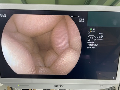 Video Gastroscope&nbsp;|&nbsp;FUJIFILM&nbsp;|&nbsp;EG-L600ZW