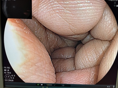 Video Gastroscope&nbsp;|&nbsp;FUJIFILM&nbsp;|&nbsp;EG-L590ZW