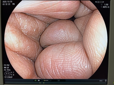 Colonoscope&nbsp;|&nbsp;FUJIFILM&nbsp;|&nbsp;EC-L590ZP