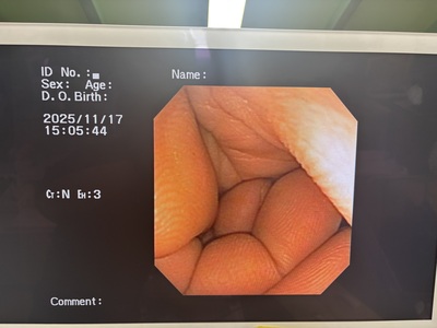 Video Gastroscope&nbsp;|&nbsp;OLYMPUS&nbsp;|&nbsp;GIF-XP150N