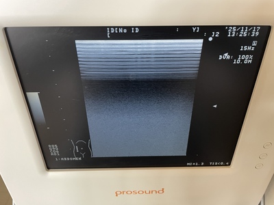 Ultrasound&nbsp;|&nbsp;HITACHI&nbsp;|&nbsp;Prosound 2