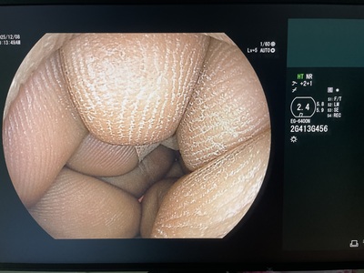 Video Gastroscope&nbsp;|&nbsp;FUJIFILM&nbsp;|&nbsp;EG-6400N