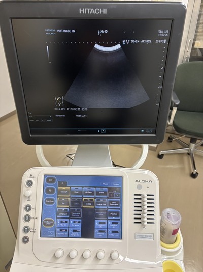Ultrasound System&nbsp;|&nbsp;HITACHI&nbsp;|&nbsp;ARIETTA 60