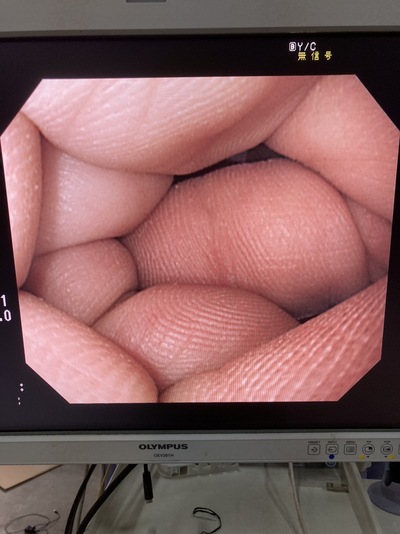 Video Gastroscope&nbsp;|&nbsp;OLYMPUS&nbsp;|&nbsp;GIF-PQ260