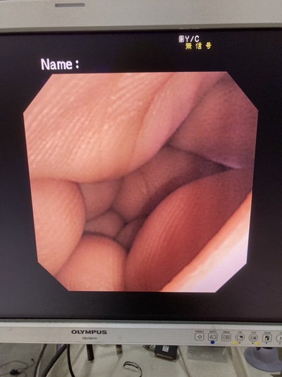 Video Gastroscope&nbsp;|&nbsp;OLYMPUS&nbsp;|&nbsp;GIF-XP260N