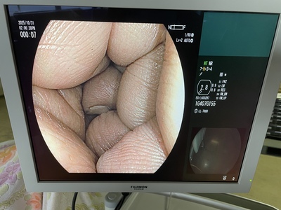 Video Gastroscope&nbsp;|&nbsp;FUJIFILM&nbsp;|&nbsp;EG-L600ZW7