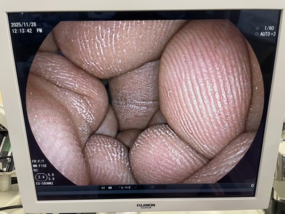 Video Gastroscope&nbsp;|&nbsp;FUJIFILM&nbsp;|&nbsp;EG-580NW2