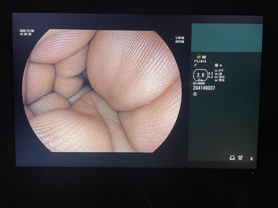 Gastroscope&nbsp;|&nbsp;FUJIFILM&nbsp;|&nbsp;EG-6600R