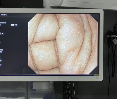 Video Gastroscope&nbsp;|&nbsp;OLYMPUS&nbsp;|&nbsp;GIF-H290Z