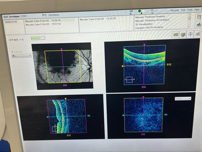 Zeiss OCT&nbsp;|&nbsp;Carl Zeiss&nbsp;|&nbsp;Cirrus 500 HD-OCT Plus