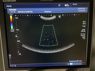 Color Doppler&nbsp;|&nbsp;CANON&nbsp;|&nbsp;Xario 200