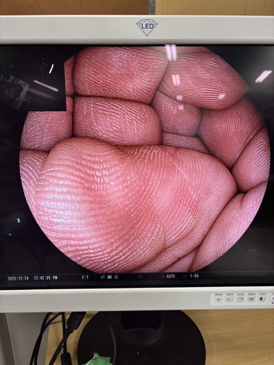 Video Colonoscope&nbsp;|&nbsp;FUJIFILM&nbsp;|&nbsp;EC-590WM3