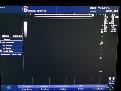 Color Doppler&nbsp;|&nbsp;GE&nbsp;|&nbsp;LOGIQ P5