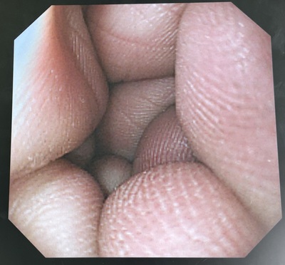 Endoscope System&nbsp;|&nbsp;OLYMPUS&nbsp;|&nbsp;LUCERA CV-260 (HDTV)