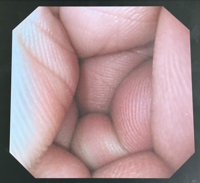 Endoscope System&nbsp;|&nbsp;OLYMPUS&nbsp;|&nbsp;LUCERA CV-260 (HDTV)