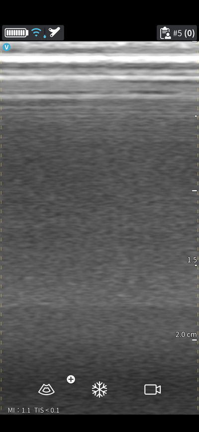 汎用超音波画像診断装置&nbsp;|&nbsp;GEヘルスケア・ジャパン株式会社&nbsp;|&nbsp;Vscan Air SLの写真