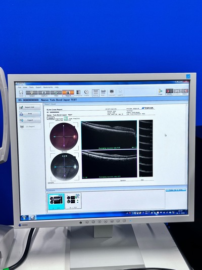 Retinal Camera and OCT Combined&nbsp;|&nbsp;TOPCON&nbsp;|&nbsp;3D OCT 1 / Maestro 1