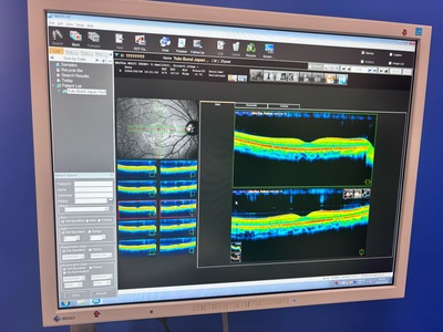 OCT with Fundus function&nbsp;|&nbsp;NIDEK&nbsp;|&nbsp;RS-3000 Advance