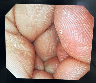 Video Gastroscope&nbsp;|&nbsp;OLYMPUS&nbsp;|&nbsp;GIF-Q240X